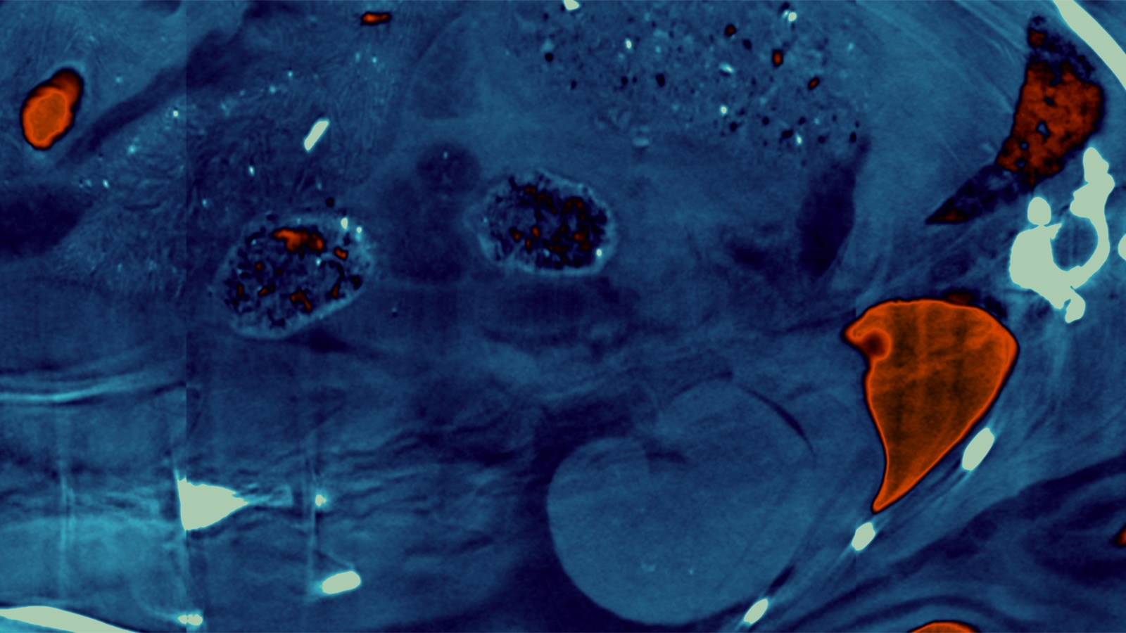 False-colour scientific tissue image